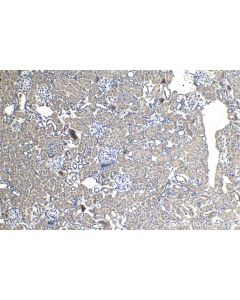 IHC easy ® UFL1 Ready-To-Use IHC Kit KHC1486 proteintech
