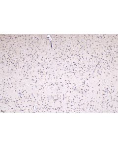 IHC easy ® UBR5 Ready-To-Use IHC Kit KHC1490 proteintech