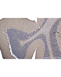 IHC easy ® TDP2 Ready-To-Use IHC Kit KHC1495 proteintech
