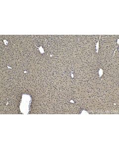 IHC easy ® UBB Ready-To-Use IHC Kit KHC1518 proteintech