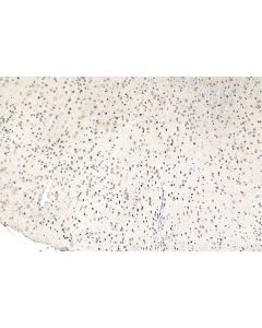 IHC easy ® TCF4 Ready-To-Use IHC Kit KHC1536 proteintech