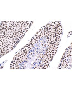 IHC easy ® NELFE Ready-To-Use IHC Kit KHC1542 proteintech