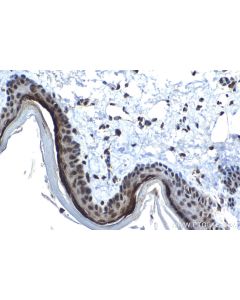 IHC easy ® ZFP36 Ready-To-Use IHC Kit KHC1567 proteintech