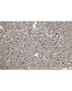 IHC easy ® VHL Ready-To-Use IHC Kit KHC1592 proteintech