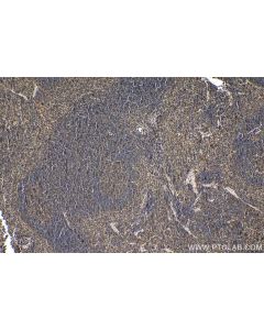 IHC easy ® TXK Ready-To-Use IHC Kit KHC1595 proteintech