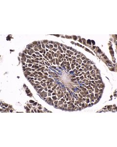 IHC easy ® UBE3A Ready-To-Use IHC Kit KHC1602 proteintech