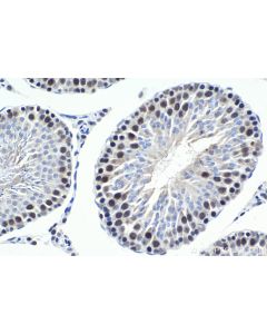 IHC easy ® WDR5 Ready-To-Use IHC Kit KHC1643 proteintech