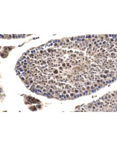 IHC easy ® NFKB2 Ready-To-Use IHC Kit KHC1659 proteintech