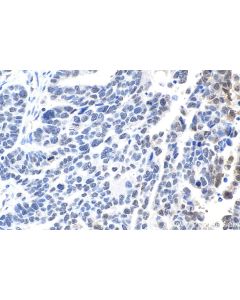 IHC easy ® MAP2K1/MEK1 Ready-To-Use IHC Kit KHC1670 proteintech