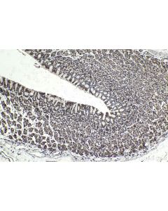 IHC easy ® CHD4 Ready-To-Use IHC Kit KHC1737 proteintech