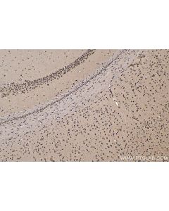 IHC easy ® VPS72 Ready-To-Use IHC Kit KHC1756 proteintech