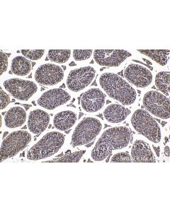 IHC easy ® TXNRD1 Ready-To-Use IHC Kit KHC1766 proteintech