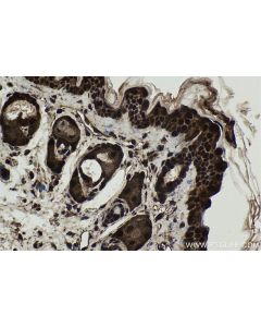 IHC easy ® USH1G Ready-To-Use IHC Kit KHC1770 proteintech