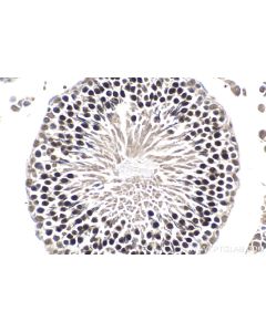 IHC easy ® RIF1 Ready-To-Use IHC Kit KHC1780 proteintech