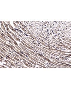 IHC easy ® SETX Ready-To-Use IHC Kit KHC1801 proteintech