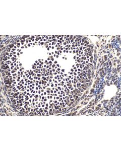 IHC easy ® TWIST2 Ready-To-Use IHC Kit KHC1844 proteintech