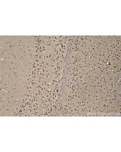 IHC easy ® DDX1 Ready-To-Use IHC Kit KHC1847 proteintech