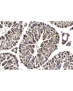 IHC easy ® USP7 Ready-To-Use IHC Kit KHC1863 proteintech