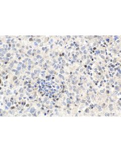 IHC easy ® UHRF1 Ready-To-Use IHC Kit KHC1887 proteintech