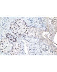 IHC easy ® TCF12 Ready-To-Use IHC Kit KHC1888 proteintech