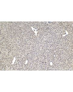 IHC easy ® WDR33 Ready-To-Use IHC Kit KHC1916 proteintech