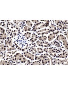IHC easy ® ZHX3 Ready-To-Use IHC Kit KHC1932 proteintech