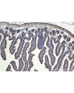 IHC easy ® MLXIP Ready-To-Use IHC Kit KHC1940 proteintech