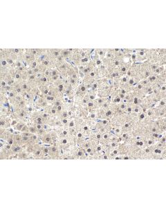 IHC easy ® ZBTB20 Ready-To-Use IHC Kit KHC1944 proteintech