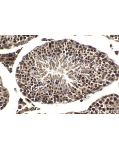 IHC easy ® ZMIZ1 Ready-To-Use IHC Kit KHC1997 proteintech