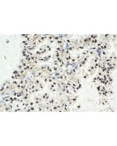 IHC easy ® USP22 Ready-To-Use IHC Kit KHC2009 proteintech