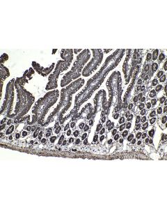 IHC easy ® USP15 Ready-To-Use IHC Kit KHC2024 proteintech