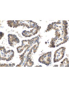 IHC easy ® UBE2C Ready-To-Use IHC Kit KHC2052 proteintech