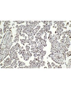 IHC easy ® RAD21 Ready-To-Use IHC Kit KHC2094 proteintech