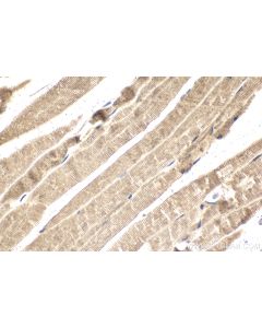 IHC easy ® ULK1 Ready-To-Use IHC Kit KHC2111 proteintech