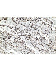 IHC easy ® TPPP Ready-To-Use IHC Kit KHC2129 proteintech