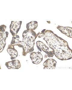 IHC easy ® VAPB Ready-To-Use IHC Kit KHC2142 proteintech