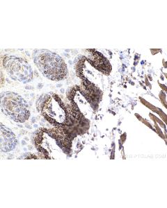 IHC easy ® UQCRC2 Ready-To-Use IHC Kit KHC2209 proteintech
