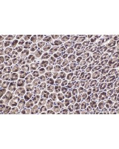 IHC easy ® RPS6KB1 Ready-To-Use IHC Kit KHC2211 proteintech