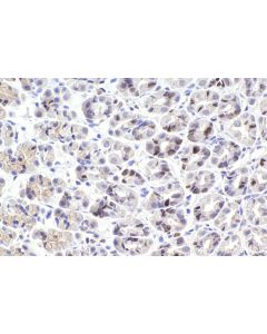 IHC easy ® RBL1 Ready-To-Use IHC Kit KHC2218 proteintech
