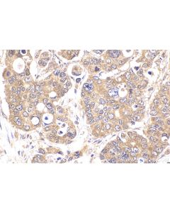 IHC easy ® TYK2 Ready-To-Use IHC Kit KHC2222 proteintech
