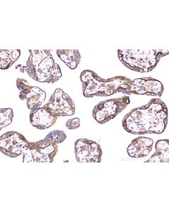 IHC easy ® USP8 Ready-To-Use IHC Kit KHC2257 proteintech