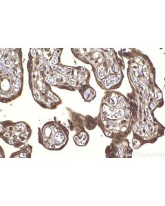 IHC easy ® MAPK8/JNK Ready-To-Use IHC Kit KHC2267 proteintech