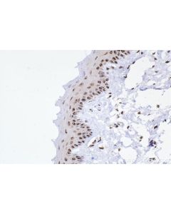 IHC easy ® ADARB1 Ready-To-Use IHC Kit KHC2368 proteintech