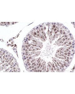 IHC easy ® DUSP2 Ready-To-Use IHC Kit KHC2394 proteintech