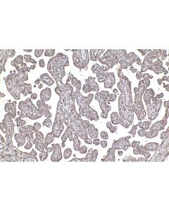 IHC easy ® TYRO3 Ready-To-Use IHC Kit KHC2395 proteintech