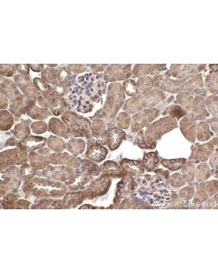 IHC easy ® SCRIB Ready-To-Use IHC Kit KHC2450 proteintech