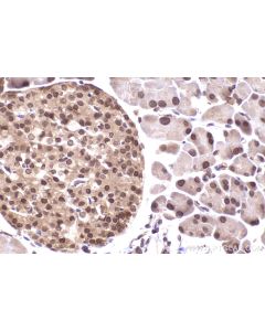 IHC easy ® UBE2V1 Ready-To-Use IHC Kit KHC2460 proteintech