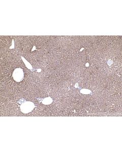 IHC easy ® DHCR24 Ready-To-Use IHC Kit KHC2488 proteintech