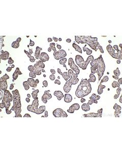 IHC easy ® VAMP3/Cellubrevin Ready-To-Use IHC Kit KHC2500 proteintech