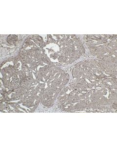 IHC easy ® DUSP6 Ready-To-Use IHC Kit KHC2521 proteintech